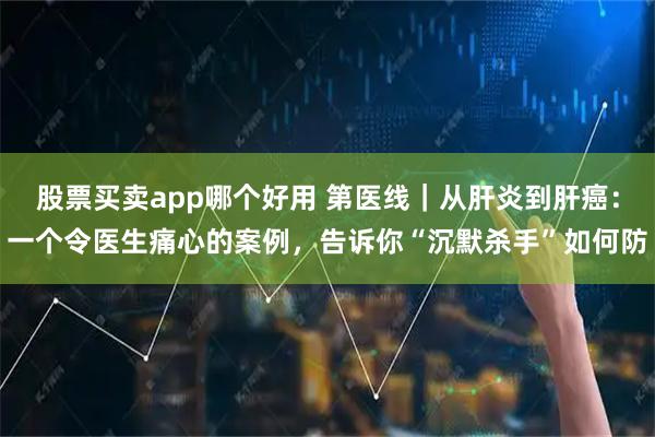 股票买卖app哪个好用 第医线｜从肝炎到肝癌：一个令医生痛心的案例，告诉你“沉默杀手”如何防